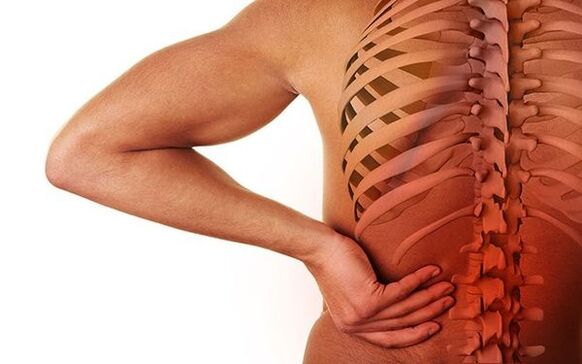 A dor é o principal síntoma neurolóxico da osteocondrose espinal