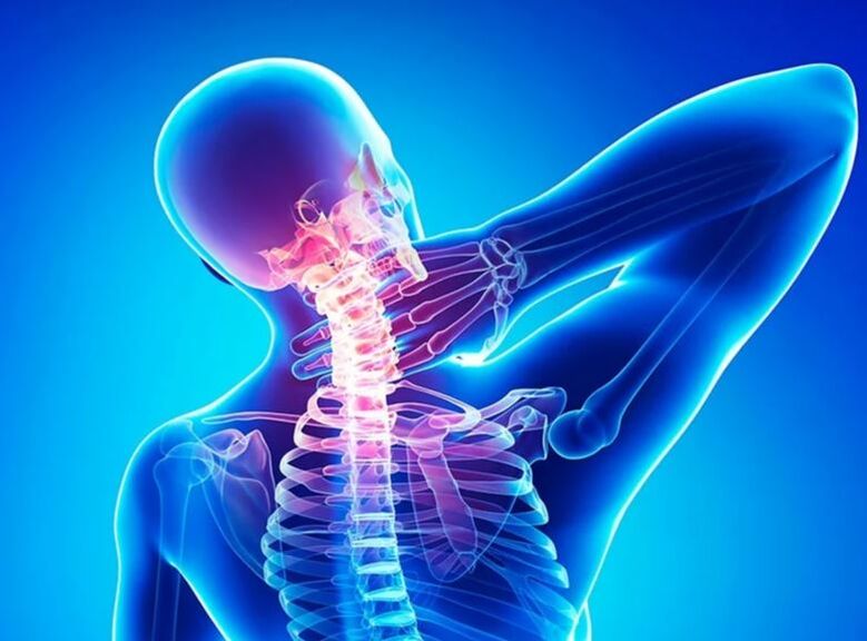 Osteocondrose da columna cervical