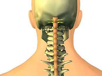 Osteocondrose da rexión do cérvix