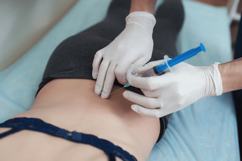 Bloqueo para osteocondrose lumbar