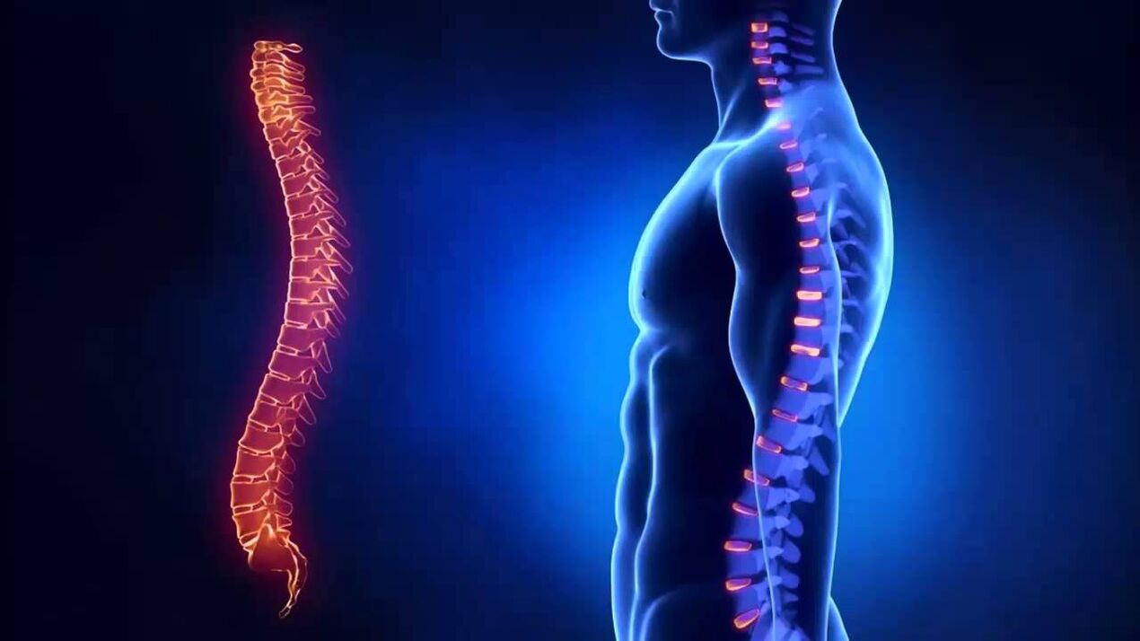 Osteocondrose